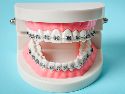 Montclair South Dental | VELscope reg  Cancer Screening, Crowns  amp  Caps and Sedation Dentistry