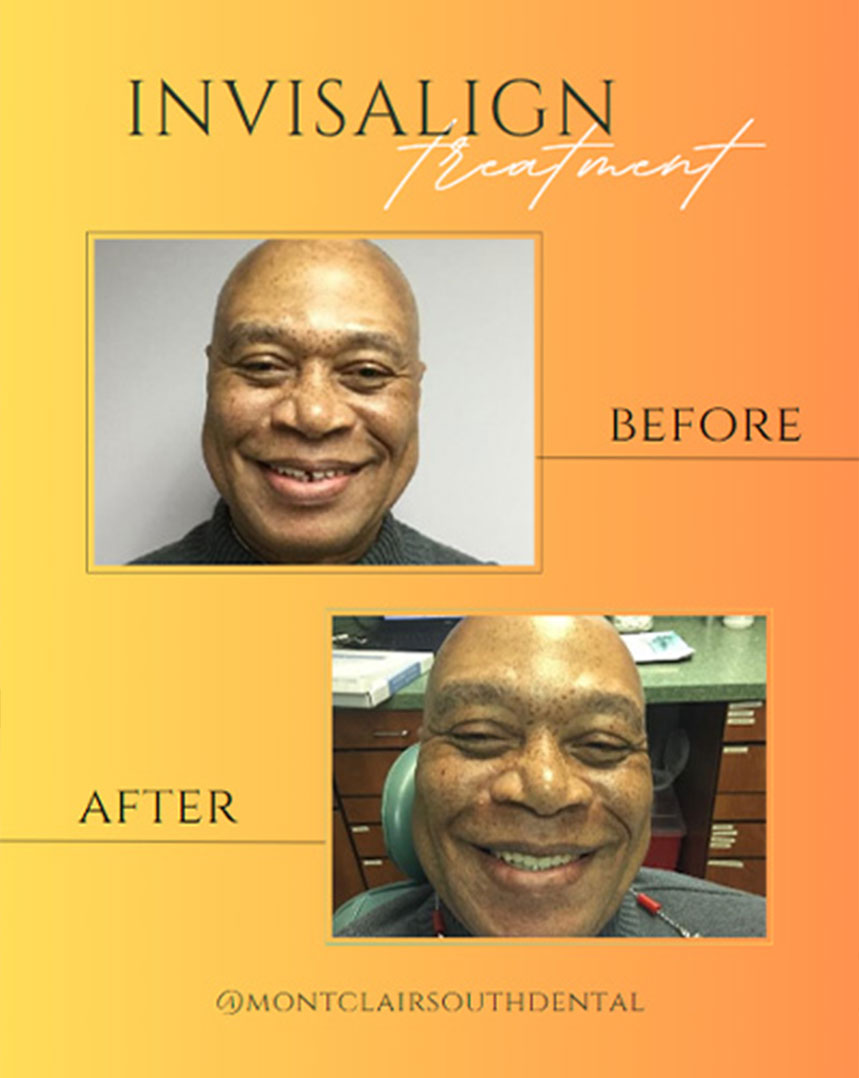 Montclair South Dental | Emergency Treatment, Orthodontics and VELscope reg Cancer Screening